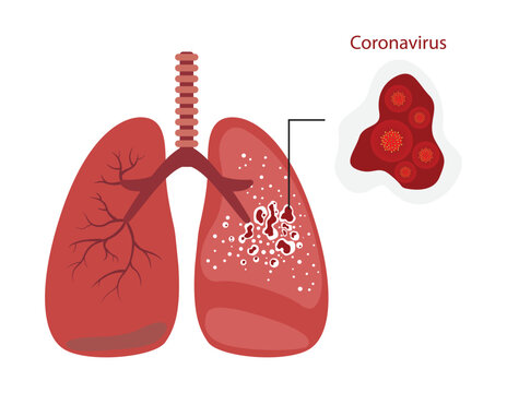 illustration of biology and medical, The coronavirus is an infection that destroys the lungs of human, Coronavirus destroys lungs, causing heart inflammation, lungs of a patient 

