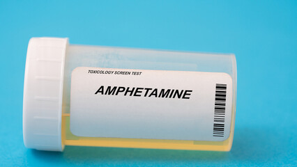 Amphetamine. Amphetamine toxicology screen urine tests for doping and drugs - obrazy, fototapety, plakaty