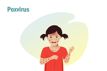 Kid suffering from poxvirus symptom, raches skin, headache and fever. For awareness in spreading of orthopoxvirus outbreak.