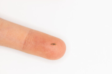 A human louse on a finger when lice was discovered in a child's hair