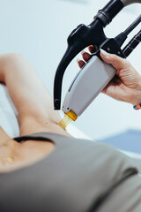 Depilaci&oacute;n l&aacute;ser