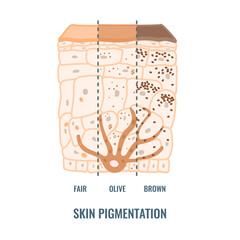 Melanin content and distribution in different skin phototypes. Pigmentation mechanism in dark, olive and light skin. Epidermis cross-section infographic medical diagram. Vector illustration.