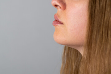 close up view woman lips push up  after lip augmentation procedure with fillers, increase lips...
