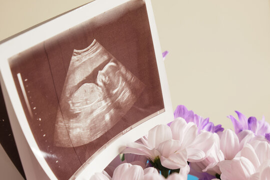 chrysanthemum flowers and snapshot of an ultrasound scan and envelpoe