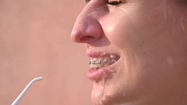 A woman with braces on her teeth uses an irrigator. 