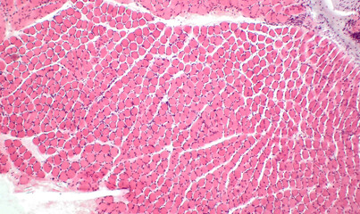 Light micrograph of a section through skeletal muscle. Muscle fibre fascicles. Haematoxylin end...