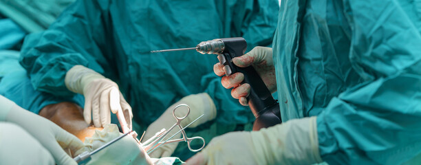 Instruments on hand, Orthopedic doctor perform in plate and screw internal fixation leg surgery...