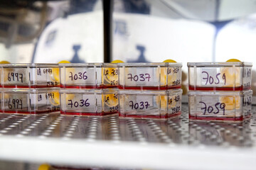 Cell culture flasks with blood samples in the incubator