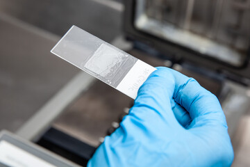 Scientist preparing slides for karyotipe and fluorescence in situ hybridization - FISH in the laboratory. Drying of the glue applied to the cover glass.