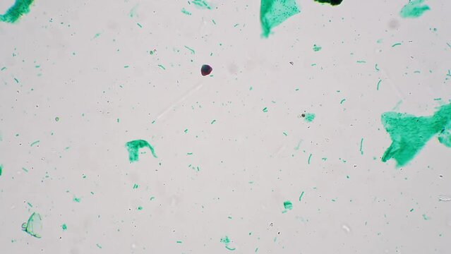 Macro footage of nostoc whole mount magnified in 100 times by microscope on bright field. Green cyanobacterium living in freshwater filmed under special lab equipment for the biological education.