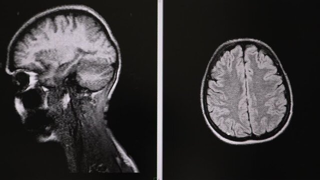 Tomography. MRI scans of the brain. Medical diagnostic examination for the presence of pathology. High quality 4k footage