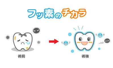 フッ素塗布治療　歯科キャラ　デンタルイラスト.