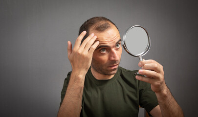 Man looking at mirror. Hair loss concept