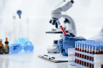 Laboratory and science experiments, chemical hand taking a blood sample tube from a rack analysis...