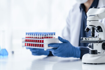 Laboratory and science experiments, chemical hand taking a blood sample tube from a rack analysis lab test in laboratory.