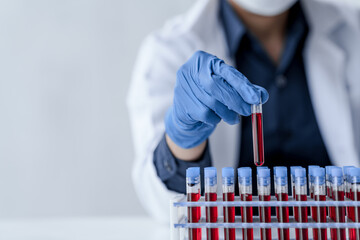 Laboratory and science experiments, chemical hand taking a blood sample tube from a rack analysis lab test in laboratory.