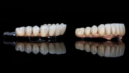 Fototapeta na wymiar two dental bars without gums with ceramic crowns on black glass with reflection, side view