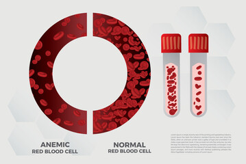 Anemia Iron red blood cell medical vector illustration medical.
 - obrazy, fototapety, plakaty