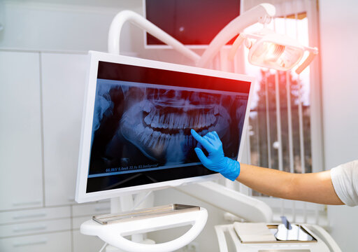 X-ray professional oral healthcare examination. Radiology surgery technologies.
