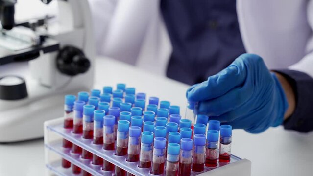 Doctor hand taking a blood sample tube from a rack with machines of analysis in the lab background, Technician holding blood tube test in the research laboratory.