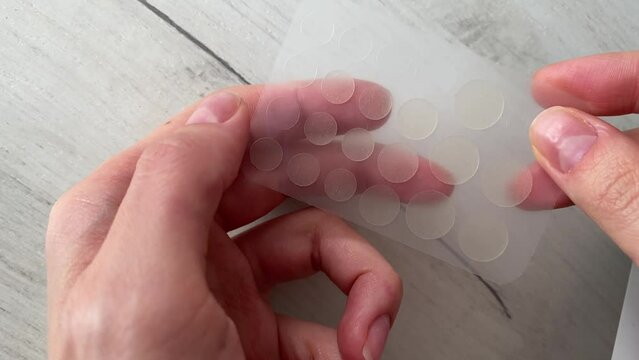 Treatment of acne anti-pickel patch for acne. A woman's hand tears off one round patch.