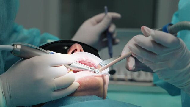 The hands of a dentist and an assistant with surgical instruments, a dental drill treat caries to a female patient. Patient wearing goggles with open mouth.