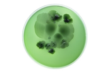 Petri dish and culture media with bacteria on white background with clipping, Test various germs,...