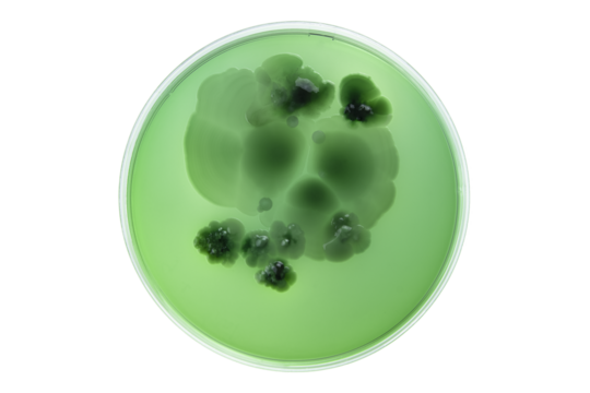 Petri dish and culture media with bacteria on white background with clipping, Test various germs, virus, Coronavirus, Corona, COVID-19, Microbial population count, Food science.