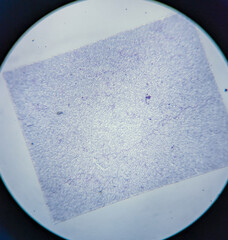 photo of human blood smear under the microscope