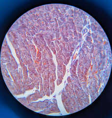 photo of heart muscle tissue under the microscope