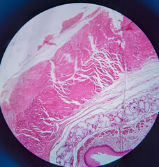 photo of esophagus tissue underr the microscope