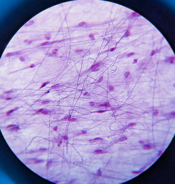 photo of loosen connective tissue underr the microscope