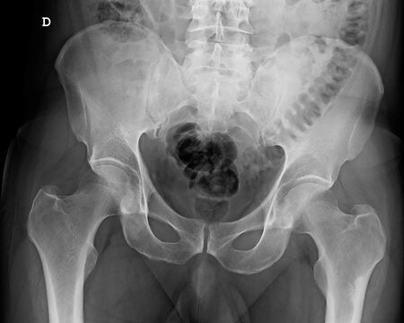 HUMAN PATHOLOGICAL AND ANATOMICAL RADIOGRAPHY