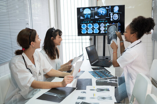 Team of medical doctor meeting in the brain research laboratory by monitor showing MRI, CT scans brain images. Group of female doctor discussing surgery and treatment with medical x-ray scan papers