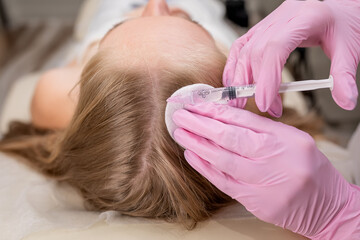 Obraz na płótnie Canvas Thewoman in salon doing mesotherapy of hair cosmetologist injects the head for hair growth.