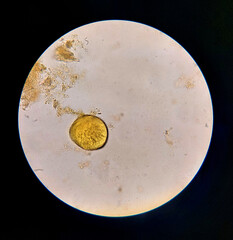 Urbanorium parasite analyzed under a microscope