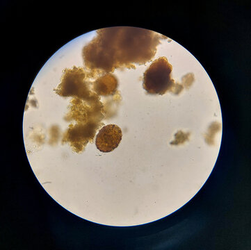 Ascaris lumbricoides egg microscope laboratory