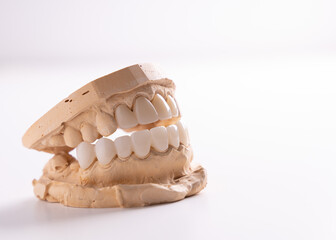 Plaster casts of teeth on a white background