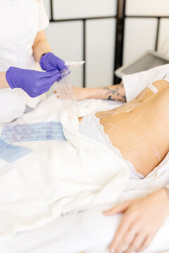 Therapist preparing body of person before lipolysis procedure