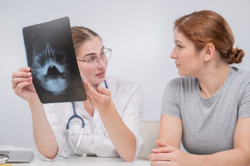 A woman doctor and a patient at the reception are discussing an x-ray of the sinuses.
