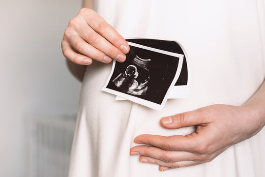 In baby nursery pregnant woman in white dress holding ultrasound image, baby sonography. Concept of pregnancy, health care, gynecology, medicine. Copy space. Happy lady enjoying photo of unborn child