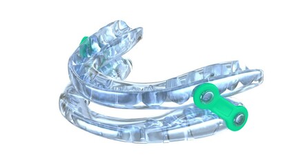 Oral appliance therapy device, sleep apnea treatment.3D animation