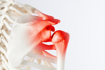 Shoulder blade pain, human skeleton body anatomy scapula and humerus bones