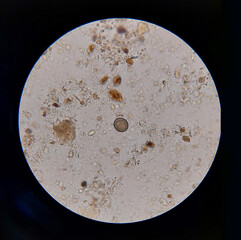 Taenia sp egg microscope  parasitology laboratory