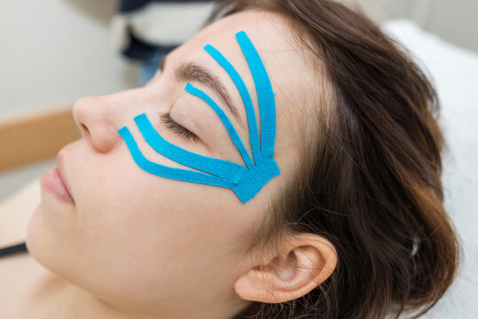 Facial tape, close-up of a girl's face with an anti-wrinkle cosmetology tape. Aesthetic taping of the face.