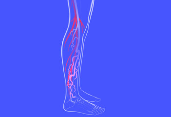 3d illustration of the venous system with varices. Transparent anatomy of the human leg.