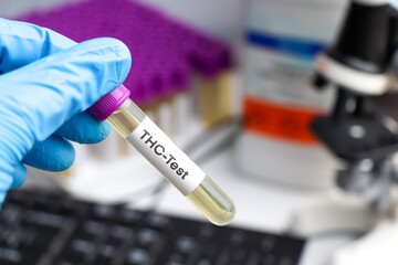 Naklejka premium Urine samples for testing THC in the laboratory