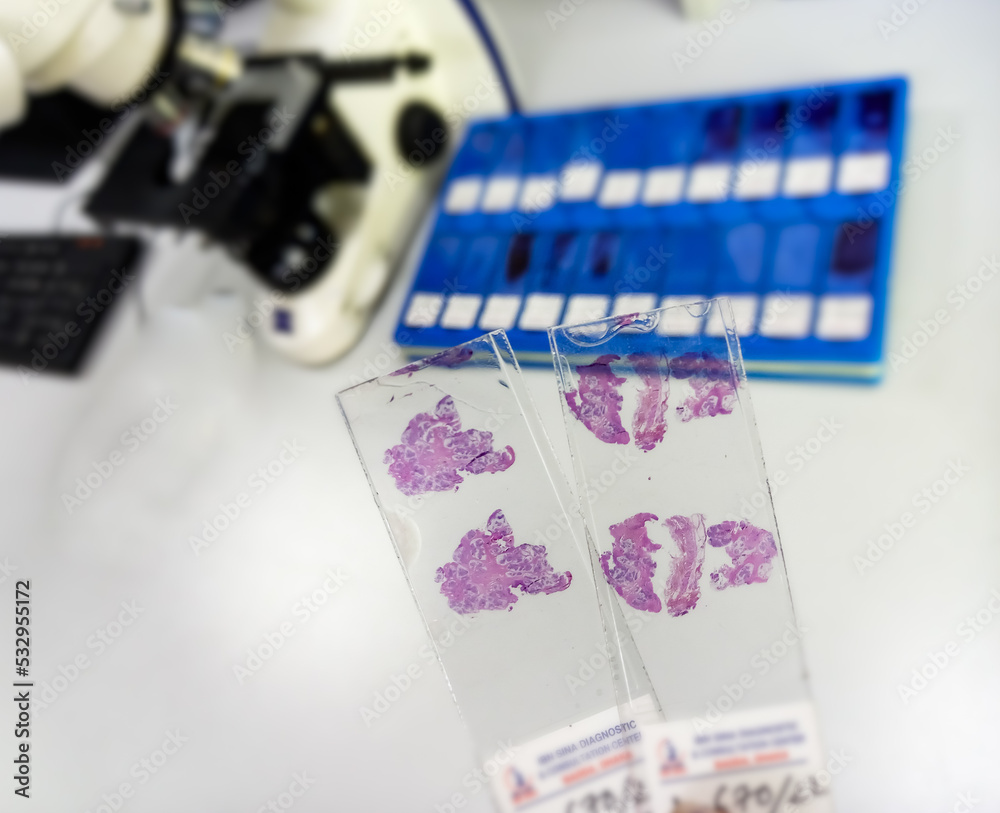 Poster Close view of Histopathology slides stained with hematoxylin and eosin or HE stain, ready for microscopic examination with Laboratory background, Histology.