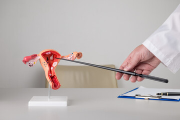 doctor gynecologist pointing model of female reproductive system on his desktop