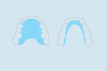 Retainer healthcare medical teeth mouth. Retainer blue on a blue background.